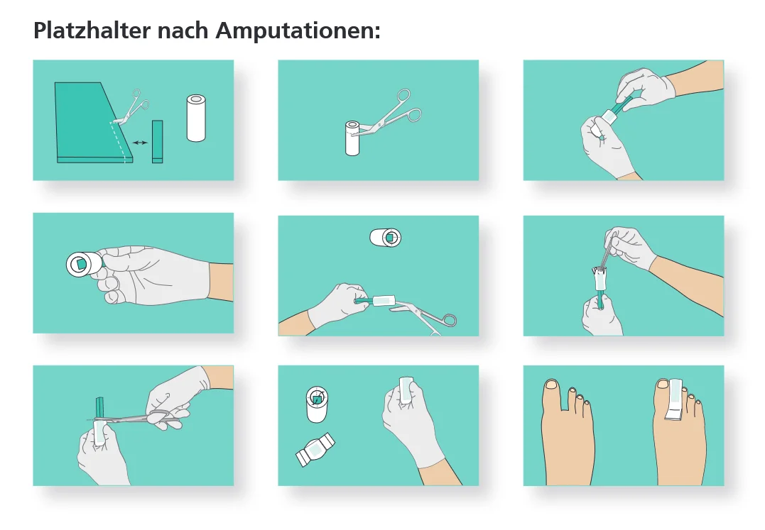 Ligasano weiß Zehenschlauch, Platzhalter nach Amputation Ligasano® weiß - Zehenschlauch unsteril