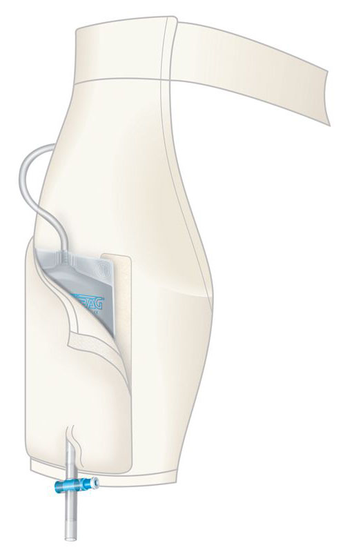 UROMED Einbeinhose zur Aufnahme eines Urinbeinbeutels