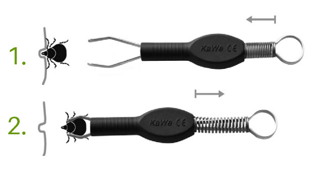 Anwendung der Zecken-Fix Zeckenpinzette, REF 11.10001.002 Anwednung der Zecken-Fix Zeckenpinzette in zwei Schritten