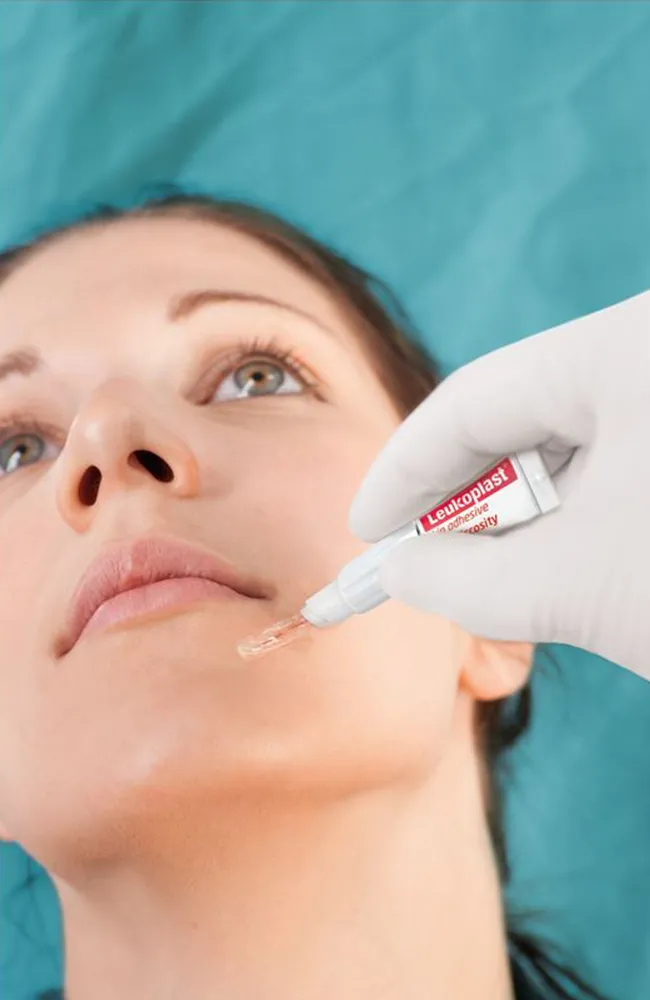 leukoplast-skin-adhesive-anwendung leukoplast-skin-adhesive-anwendung-im-gesicht
