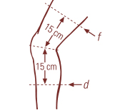 knieorthese-grafikt.jpg
